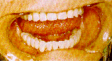 Figura 4