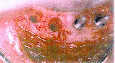 Figura 3