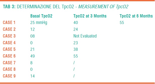 Tabella 3