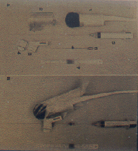 Carcinoma epatico figura 4