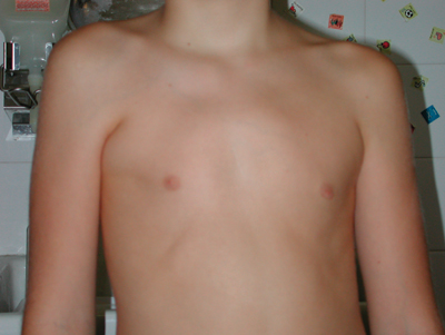 Fig. 1 - Torace